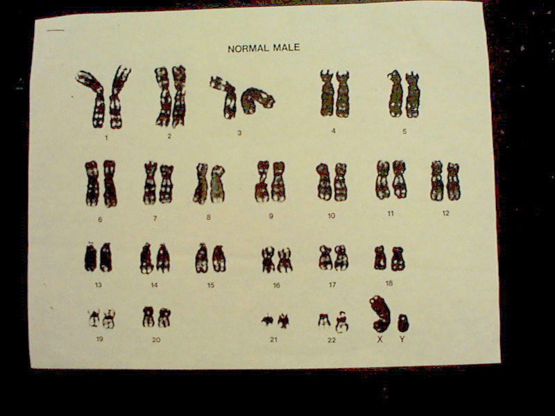 Karotype 2