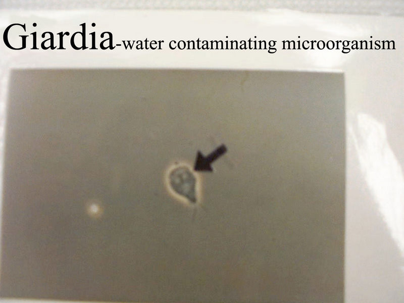 giardia